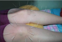 你知道骨性关节炎和类风湿关节炎有什么区别吗?.jpg 你知道骨性关节炎和类风湿关节炎有什么区别吗?