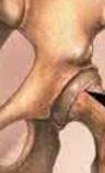 ͭڷʪҽԺ:йʪԹؽײͬĻ֪ʶ